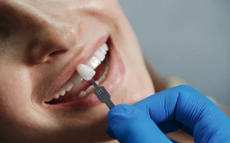 Veneers Fitting Service In Malaysia - Sinaran Dental Clinic