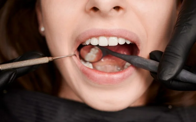 Dental and Tooth Filling Services - Sinaran Dental Clinic