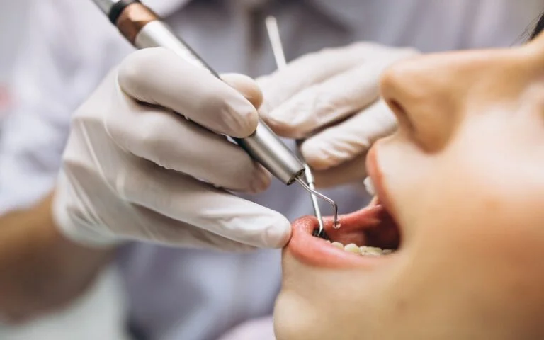 Teeth Scaling & Polishing Services - Sinaran Dental Clinic